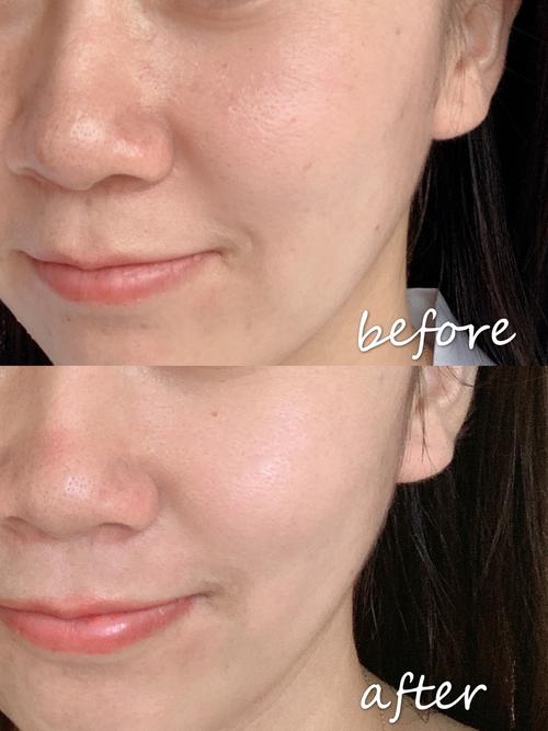 别只跟风买水悠季极光水！这些核心成分你得先搞懂