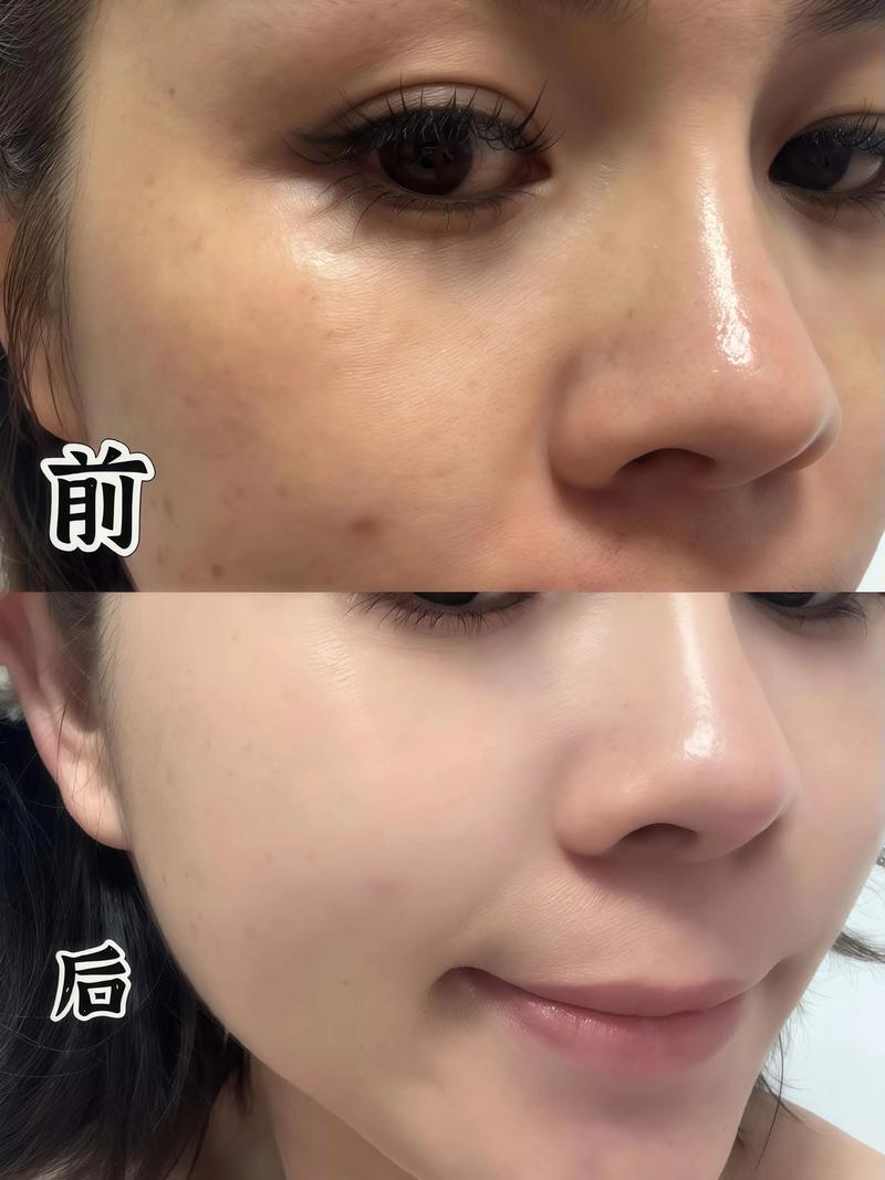 水悠季极光水产品介绍｜敏肌焕亮神器全解