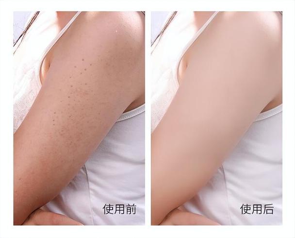 水悠季官方维 E 身体乳，秋冬补水修护粗糙肌肤身体乳